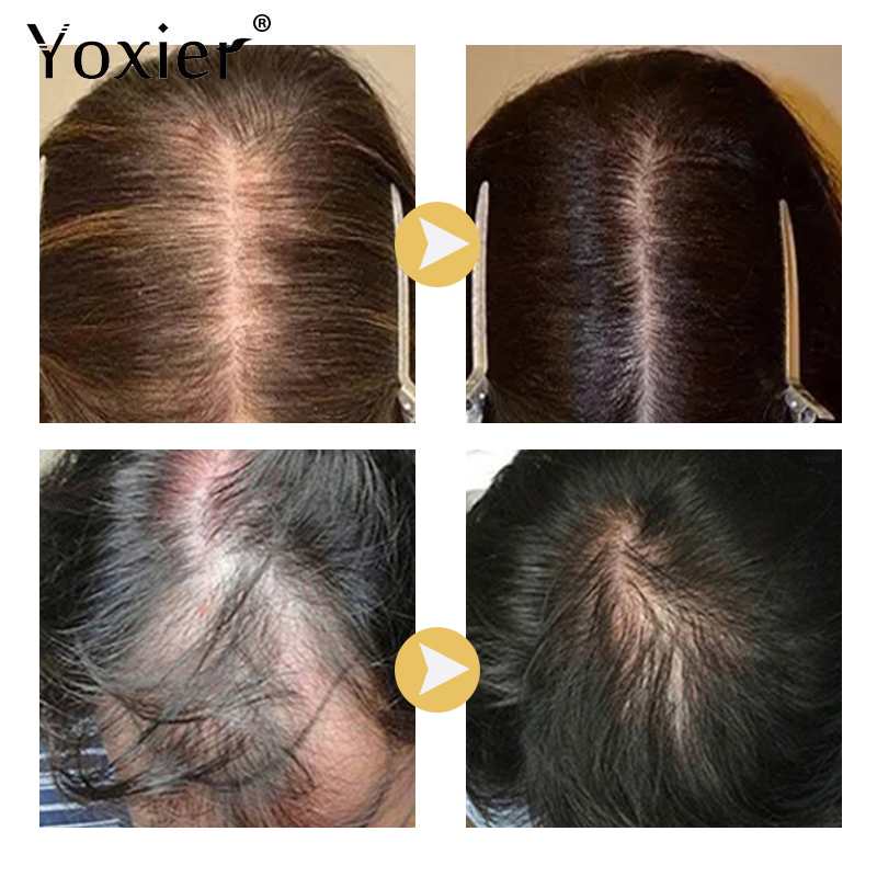 Intensive Growth Serum Prevent - Hair Care Growth recension och pris