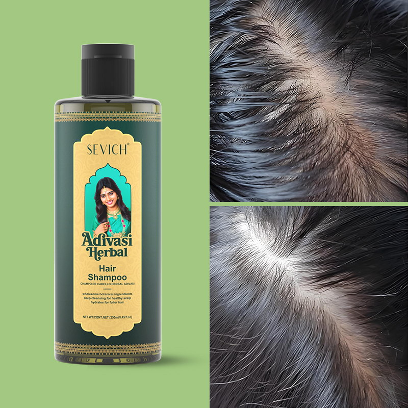 SEVICH Herbal Hair Growth Oil  - Hair Care India recension och pris
