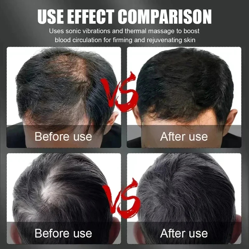 660nm 850nm Red Light Infrared - Hair Care Growth recension och pris